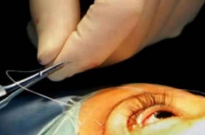 Six lose eyesight after cataract surgery in Varanasi