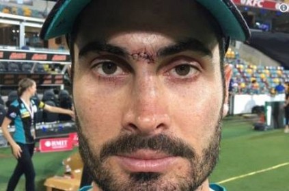 Ben Cutting tries to catch a ball with his face and fails viral video